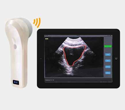 BProbe-2 4D Wireless Probe Bladder Ultrasound Scanner