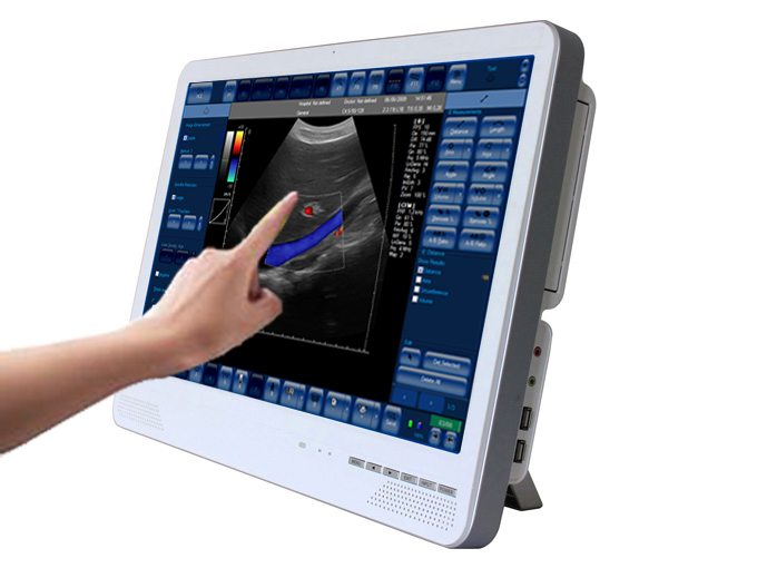 C6 Color Doppler Ultrasound System(Touch Screen)