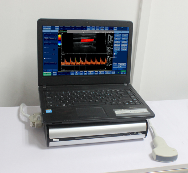 CBox-3 Color Doppler Ultrasound Box