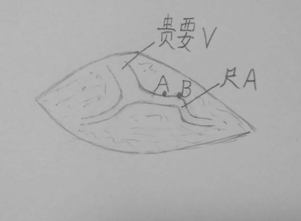 1642642386200618.png