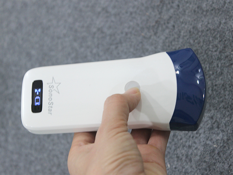 How to Choose a Cost‑Effective Wireless Handheld Ultrasound for Hospital Procurement How to Choose a Cost‑Effective Wireless Handheld Ultrasound for Hospital Procurement