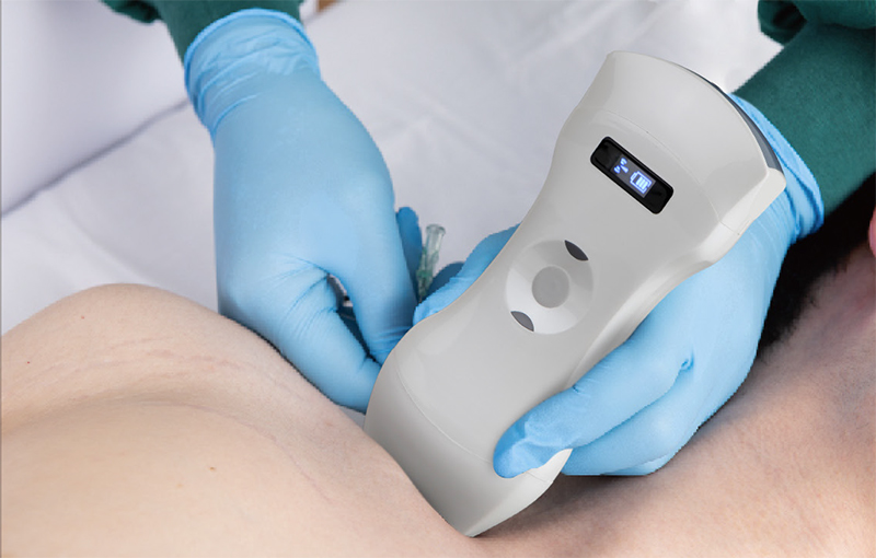Application of Portable Imaging Technology by Handheld Ultrasound Manufacturers in Primary Care and Application of Portable Imaging Technology by Handheld Ultrasound Manufacturers in Primary Care and