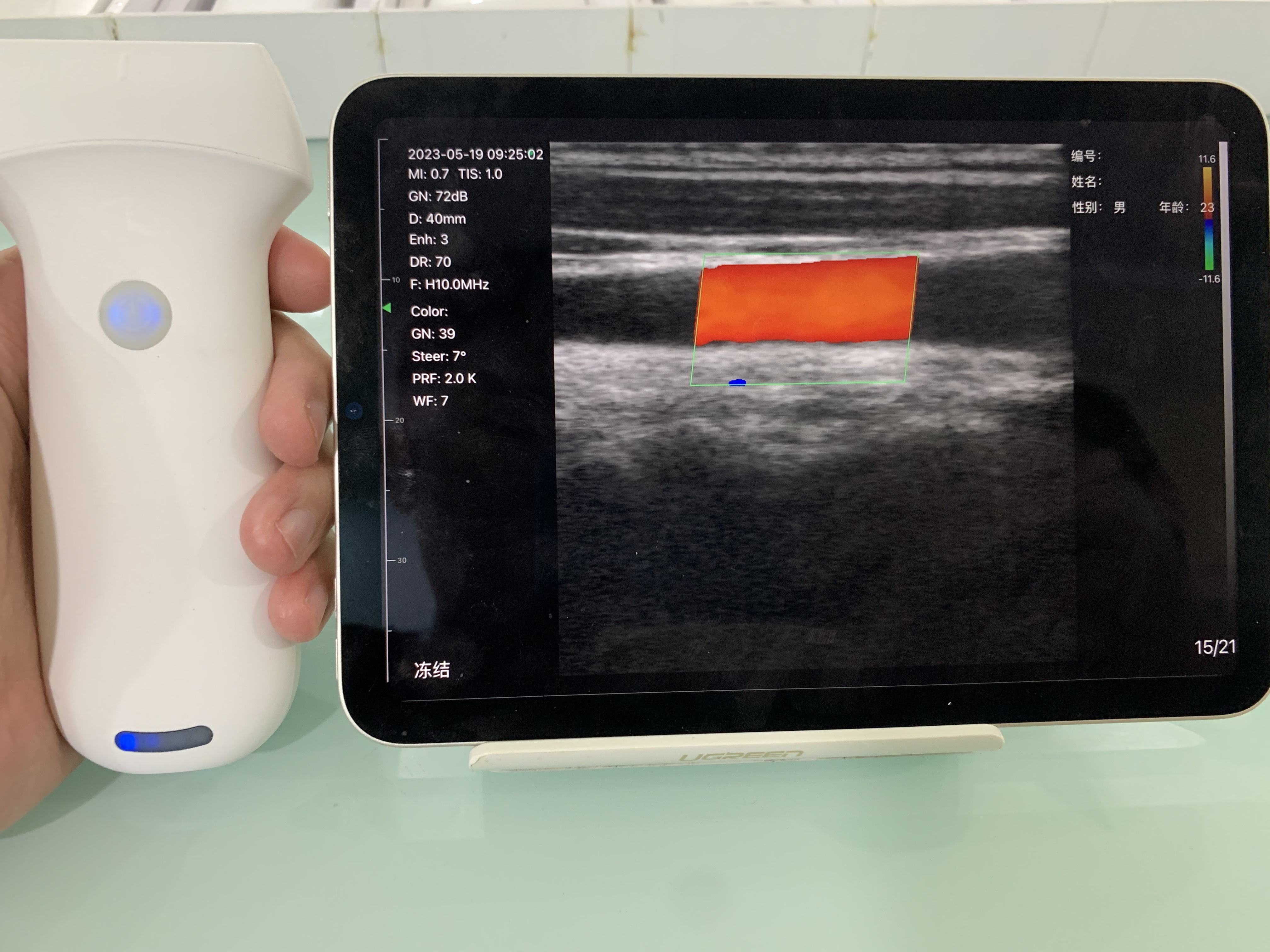 8L linear palm doppler ultrasound scanner