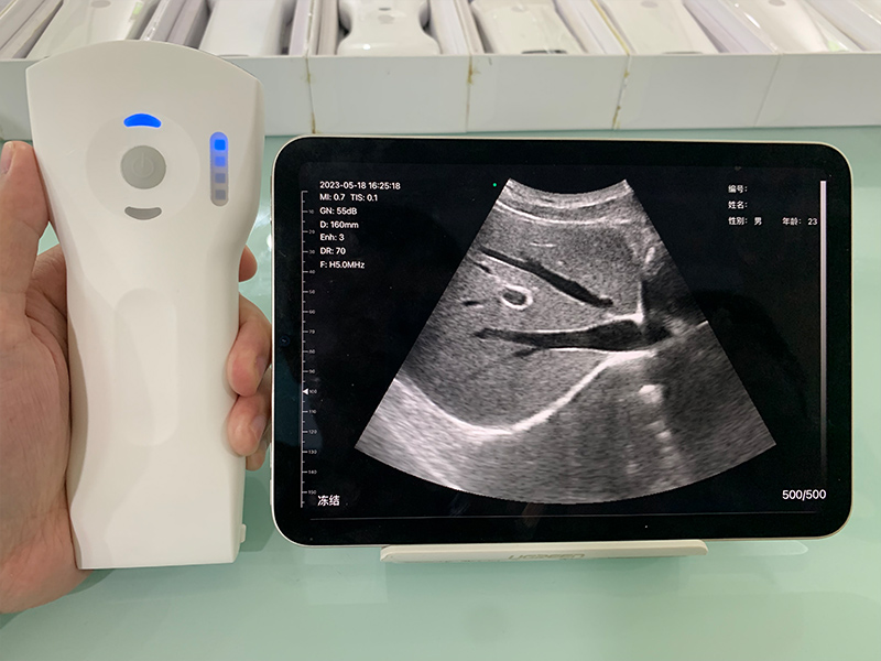 Wireless‑Handheld Ultrasound Equipment Procurement: Practical Selection Guide for Medical Institutio Wireless‑Handheld Ultrasound Equipment Procurement: Practical Selection Guide for Medical Institutio