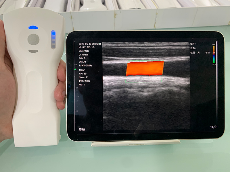 Application of Portable Imaging Technology by Handheld Ultrasound Manufacturers in Primary Care and Application of Portable Imaging Technology by Handheld Ultrasound Manufacturers in Primary Care and