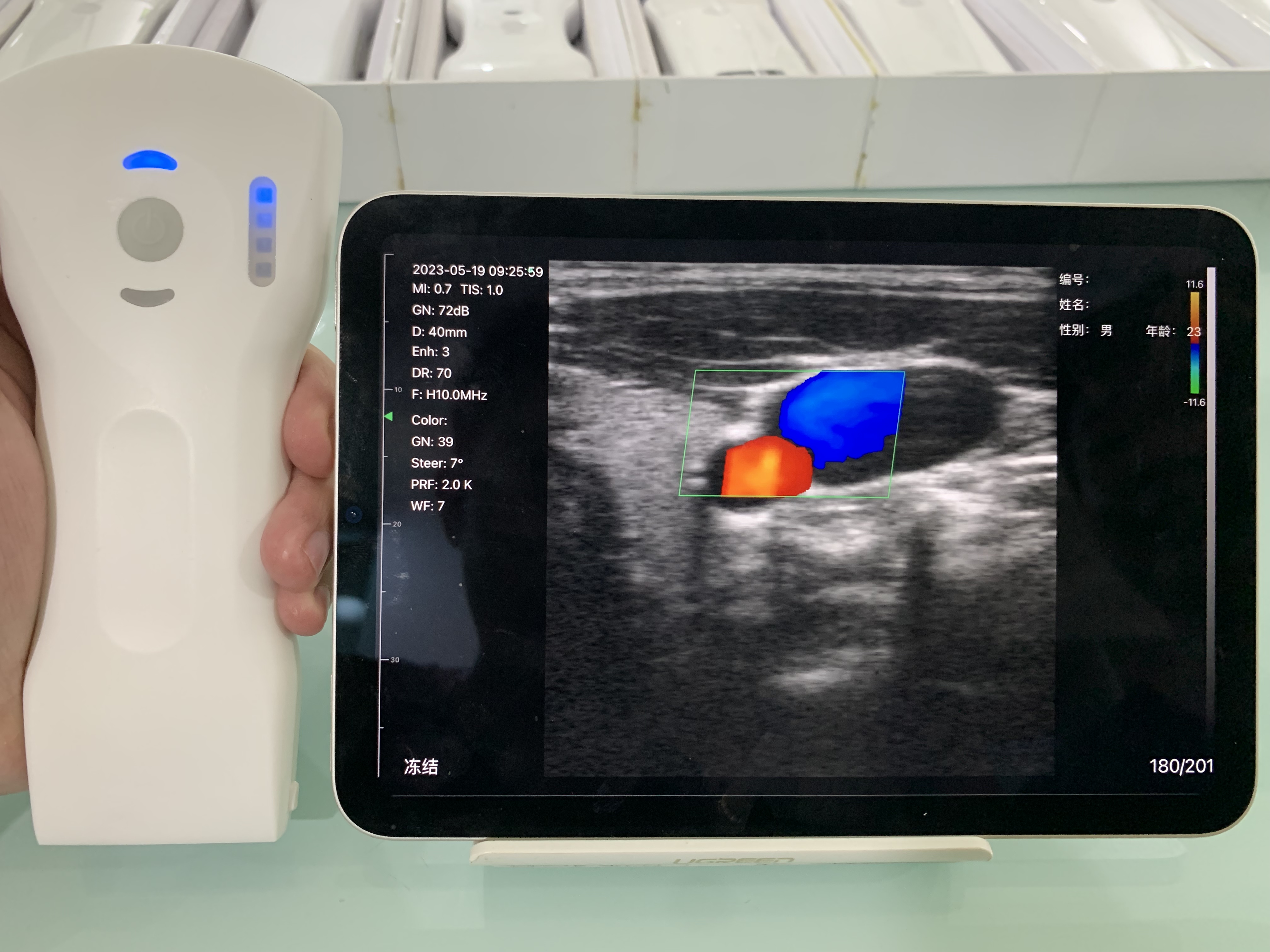 8CPL 3in1 palm doppler ultrasound scanner(VIP Exclusive)