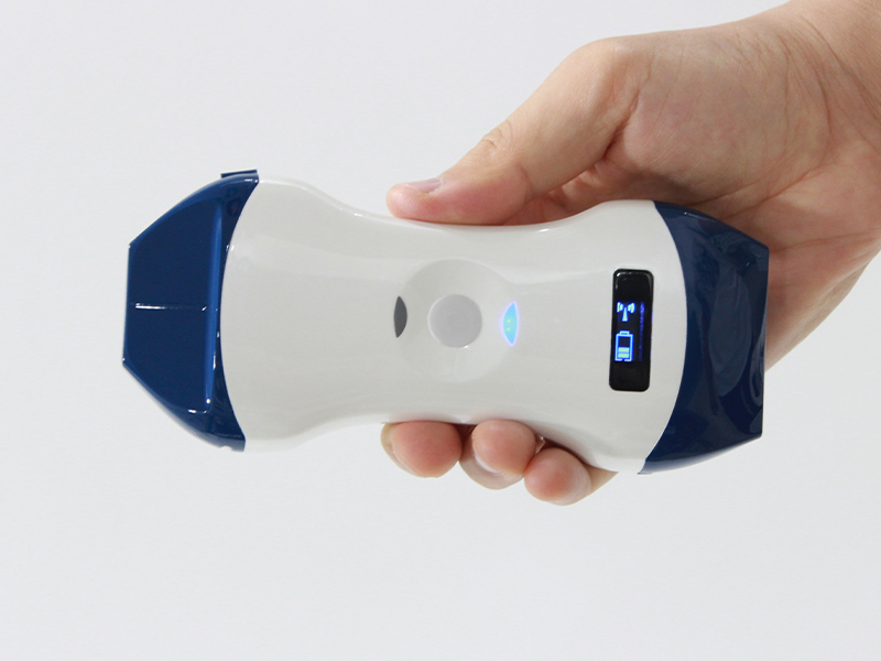 Is It Worth Deploying Wireless Handheld Ultrasound in Primary‑Care Clinics? Is It Worth Deploying Wireless Handheld Ultrasound in Primary‑Care Clinics?