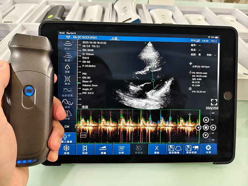 Wireless Handheld Ultrasound Manufacturer Analysis: Department-Specific Selection Guide Wireless Handheld Ultrasound Manufacturer Analysis: Department-Specific Selection Guide