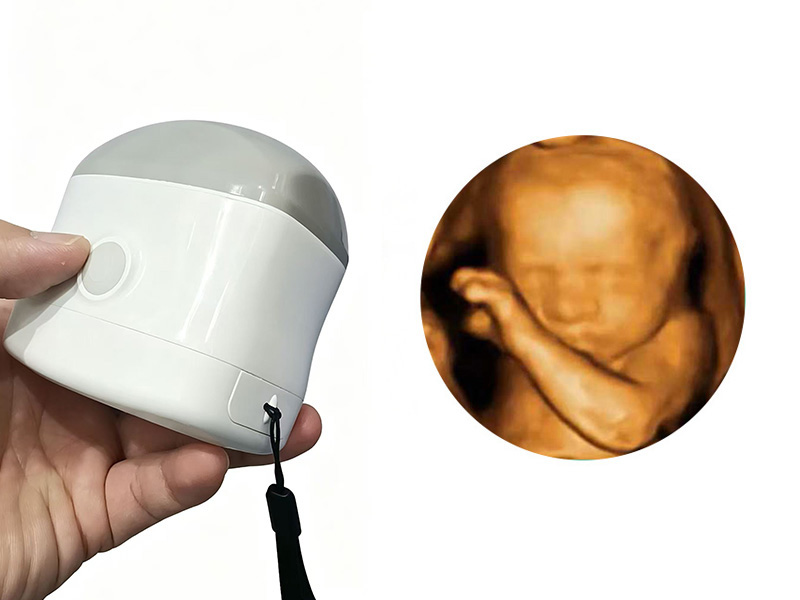 Convex Array 4D Volume Imaging Handheld Ultrasound