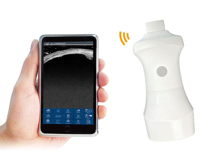 CProbe-8UBM micro-convex palm doppler ultrasound scanner