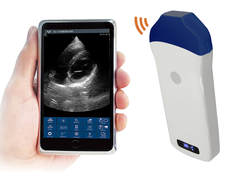 5PA phased array palm doppler ultrasound scanner(with CW)