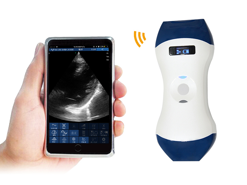 5LPA 2in1 palm doppler ultrasound scanner