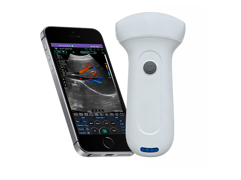 7C convex palm doppler ultrasound scanner