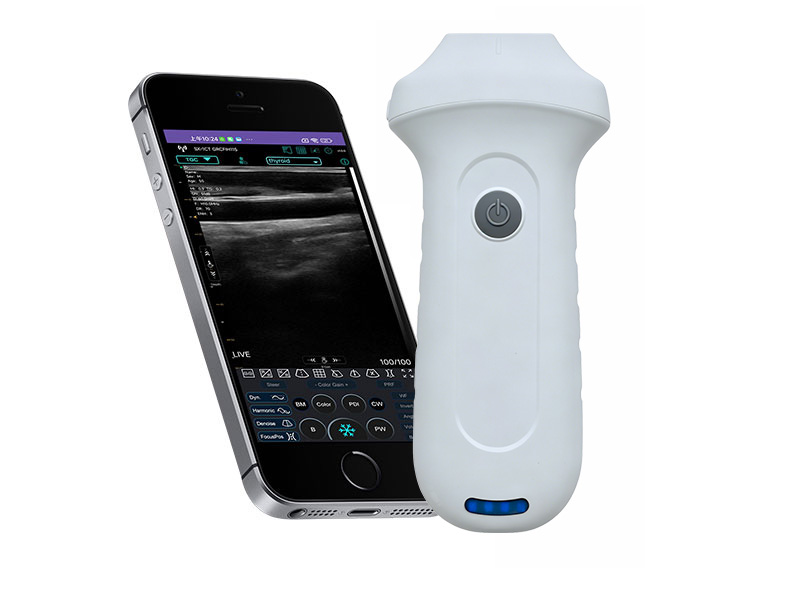 7N linear palm doppler ultrasound scanner