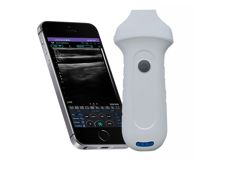 7H linear palm doppler ultrasound scanner(VIP Exclusive)
