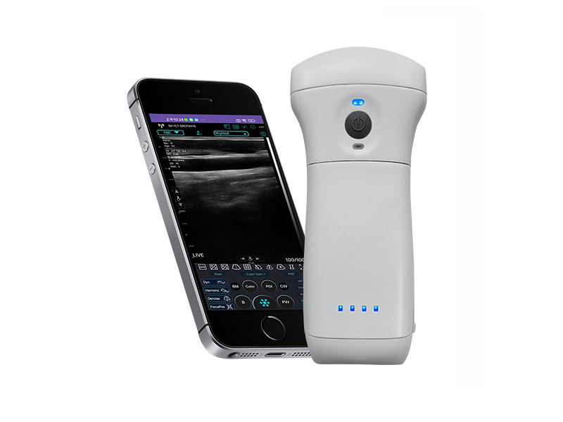 9CPL Replaceable Battery 3in1 palm doppler ultrasound scanner(VIP Exclusive)