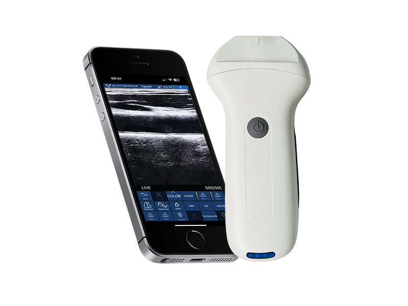 8N linear palm doppler ultrasound scanner