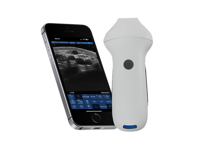 8H linear palm doppler ultrasound scanner
