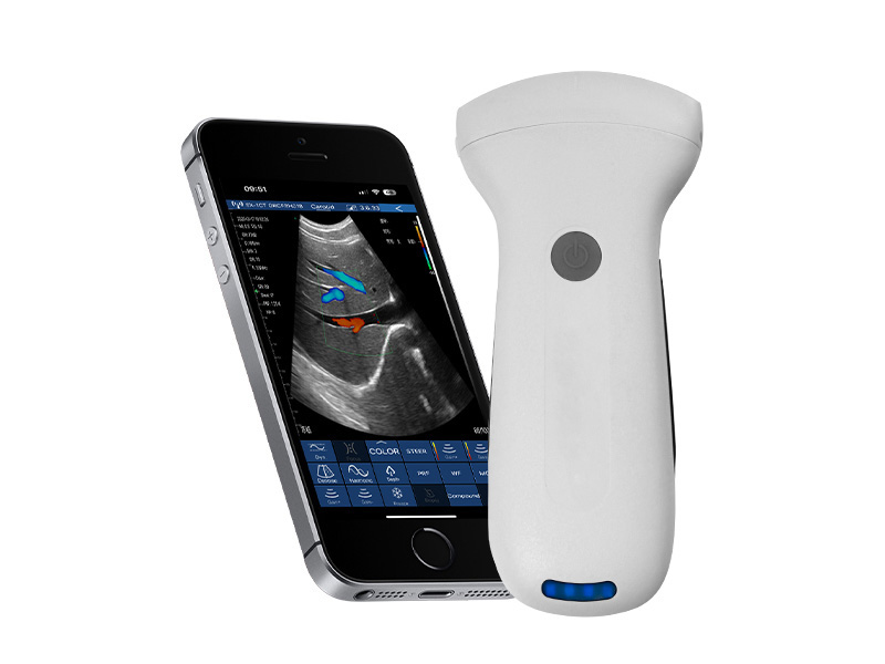 8C convex palm doppler ultrasound scanner