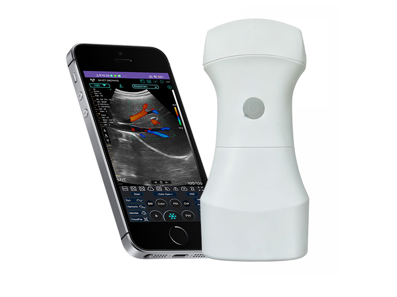 9C Replaceable Battery convex palm doppler ultrasound