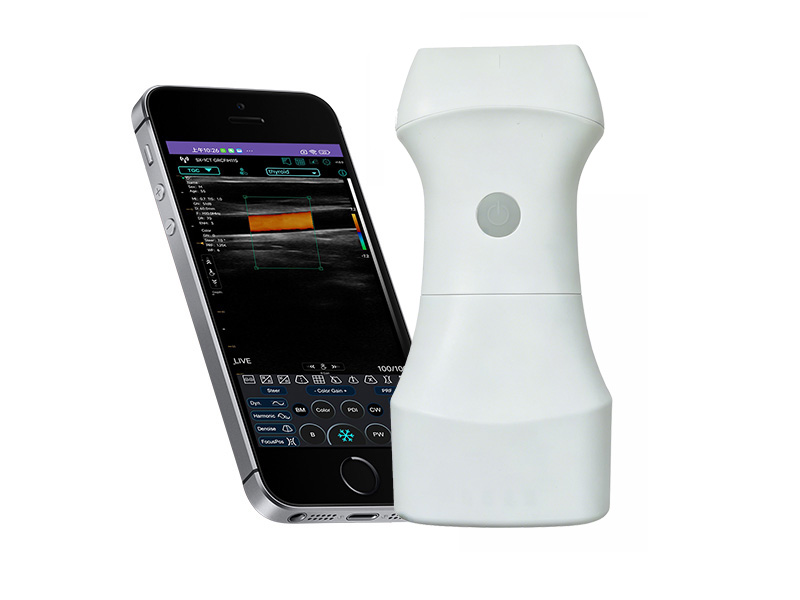 9L Replaceable Battery linear palm doppler ultrasound scanner(VIP Exclusive)