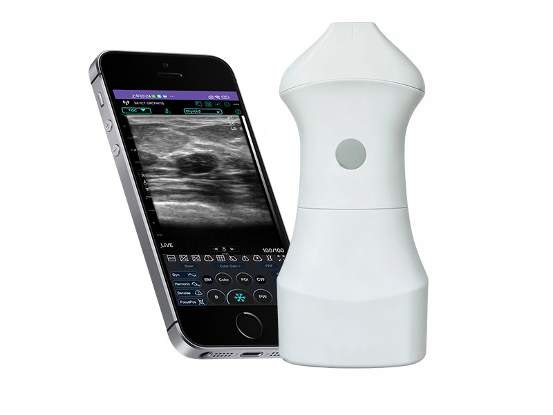 9S Replaceable Battery linear palm doppler ultrasound