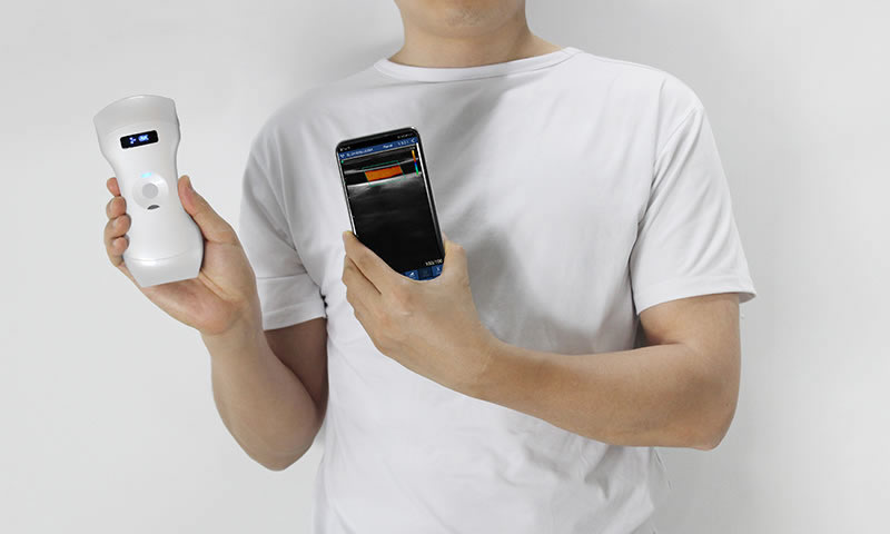 Wireless Handheld Pocket Ultrasound vs. Traditional Cart-Based Ultrasound: What Are the Differences Wireless Handheld Pocket Ultrasound vs. Traditional Cart-Based Ultrasound: What Are the Differences