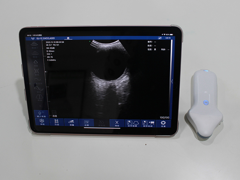 Clinical Procurement Guide for Sonostar Portable Ultrasound Diagnostic Devices