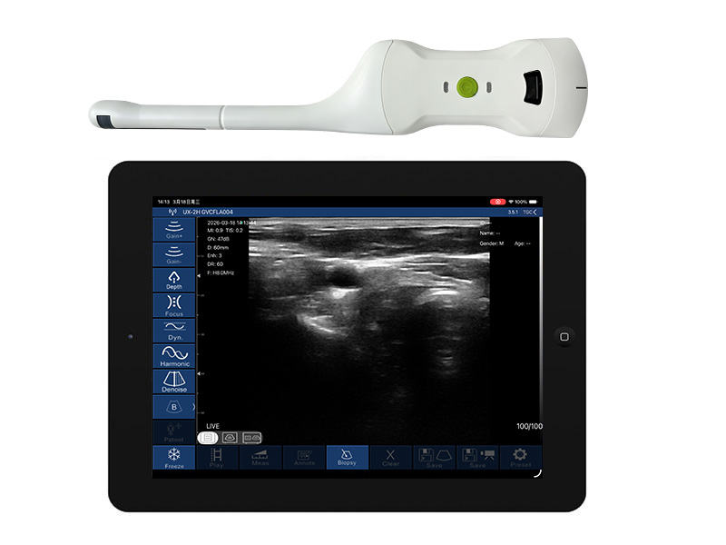 5CR biplane rectal palm doppler ultrasound scanner